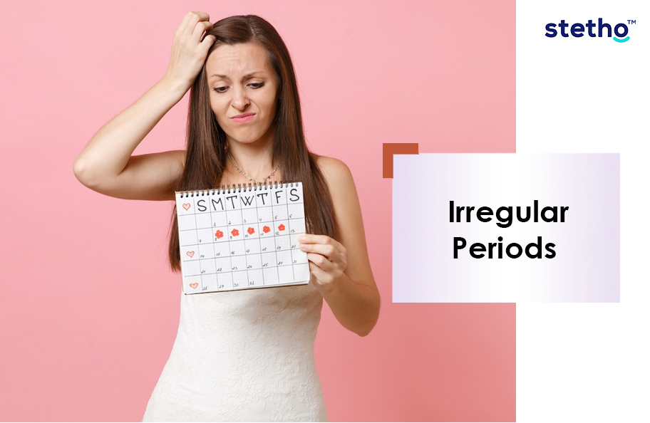 Irregular Peroids
